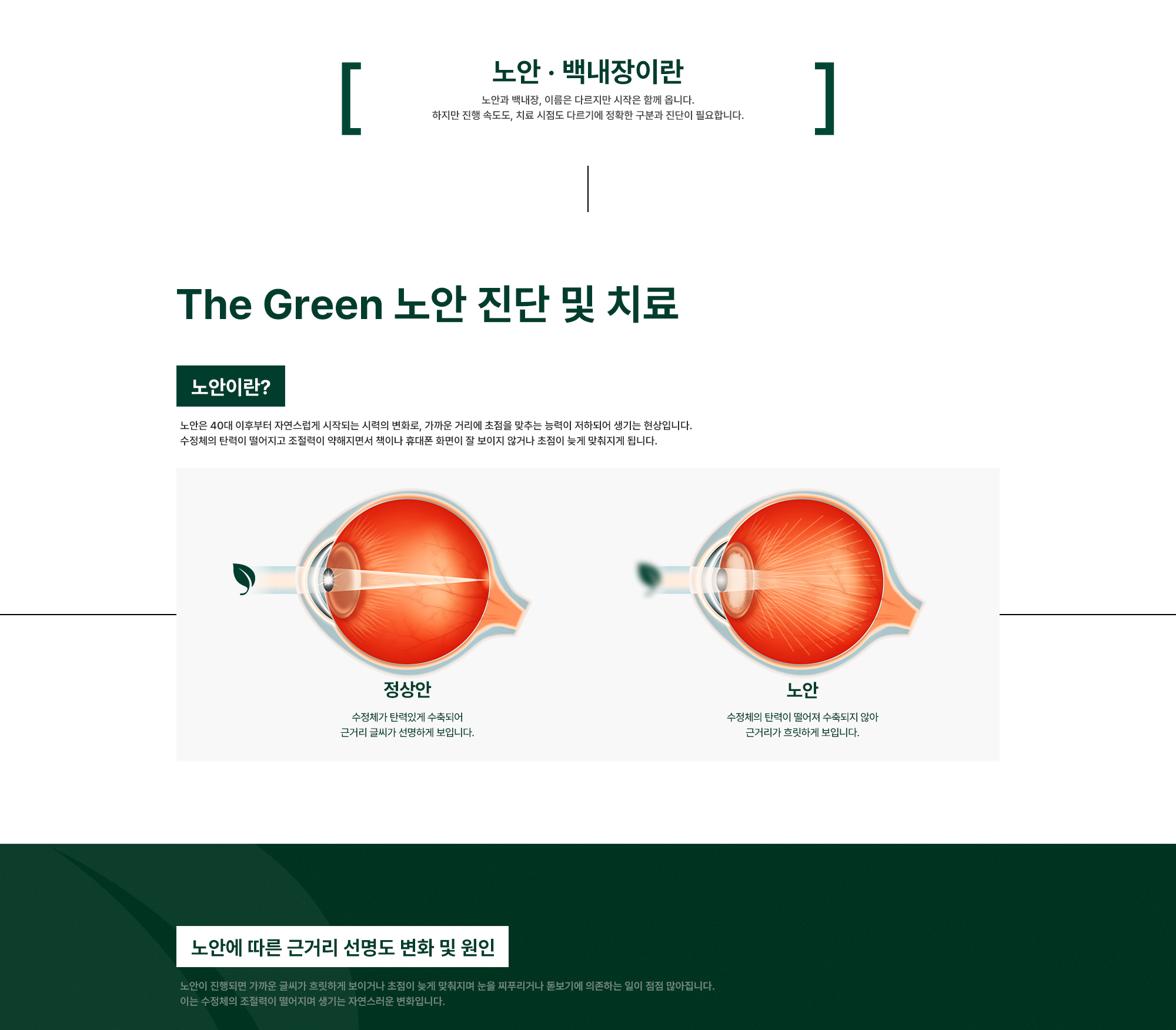 The Green 노안 진단 및 치료