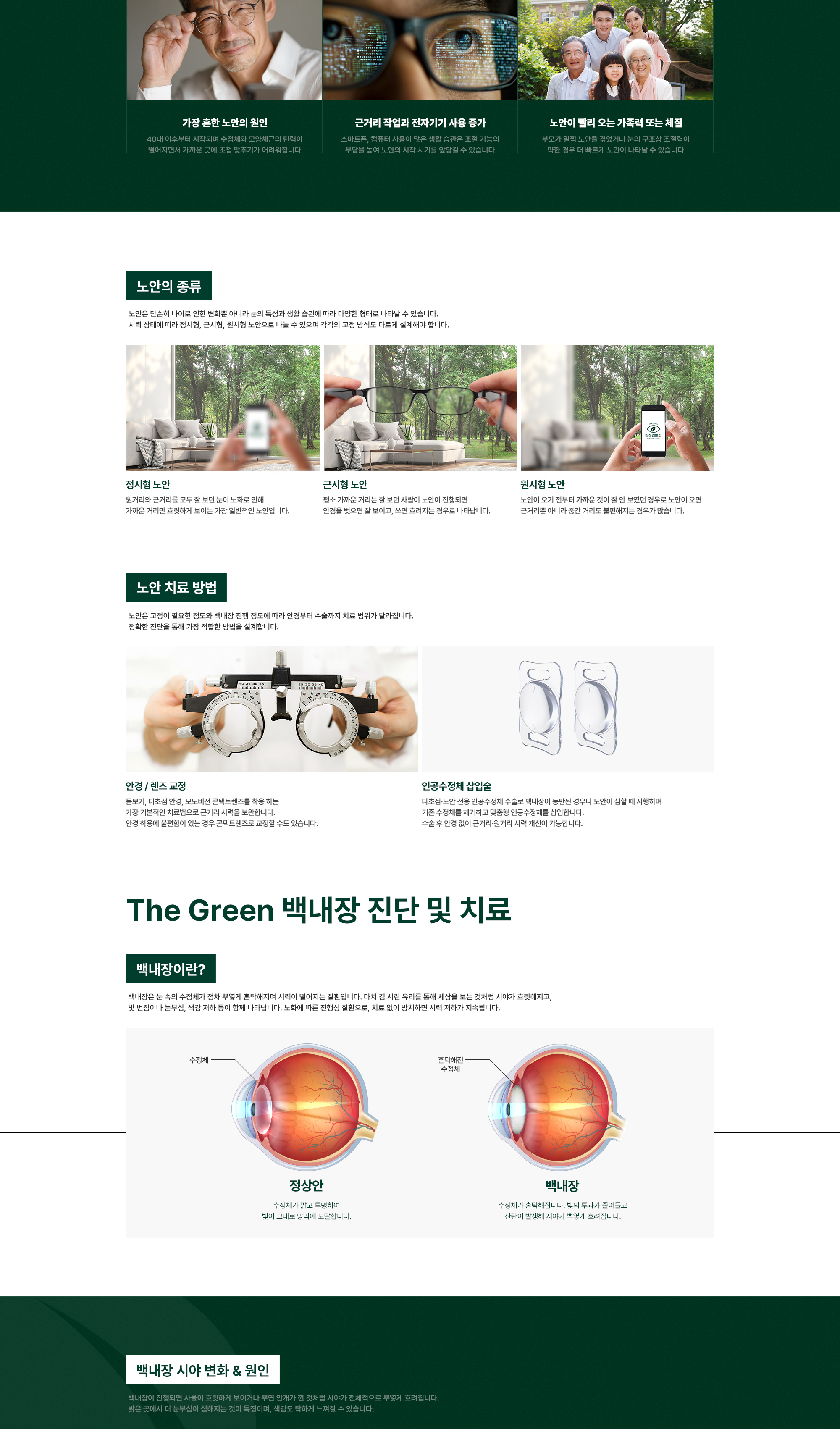 The Green 백내장 진단 및 치료