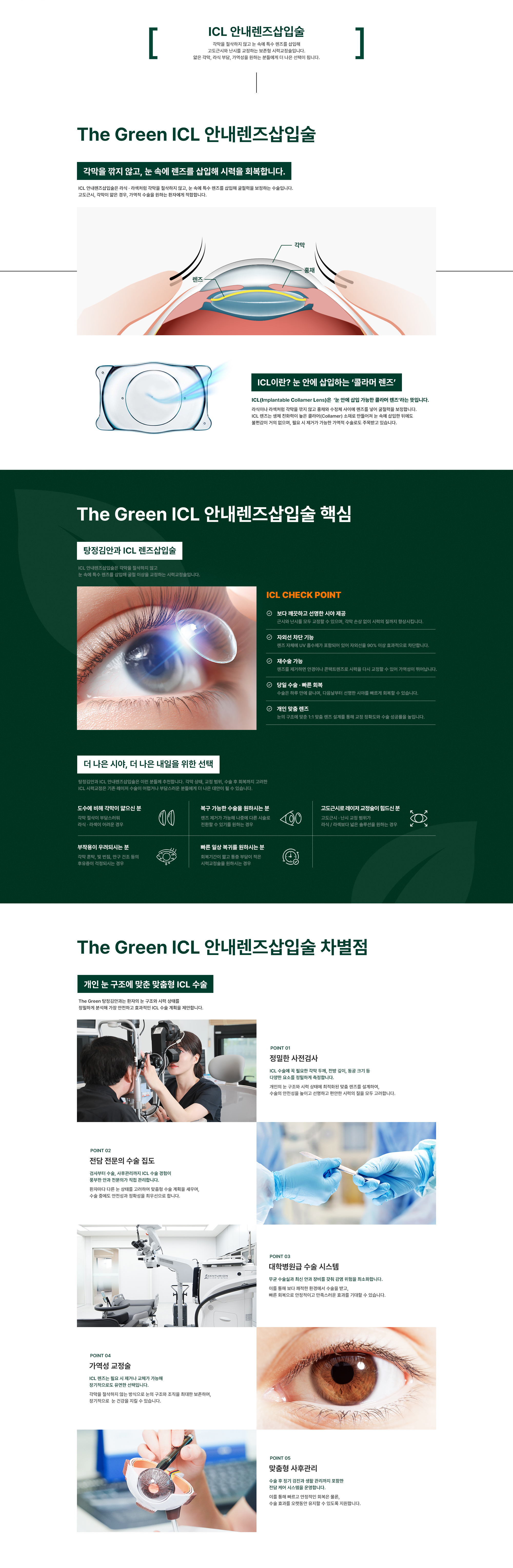 ICL 안내렌즈삽입술
